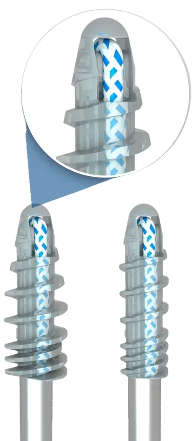 Bioanchor® — Âncoras Reabsorvíveis em PLLA