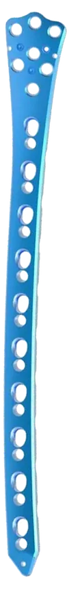 Placa Distal de Fêmur Miplate