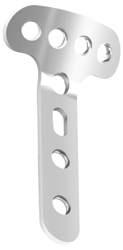 Placa T 56mm - Pequenos Fragmentos sem Bloqueio