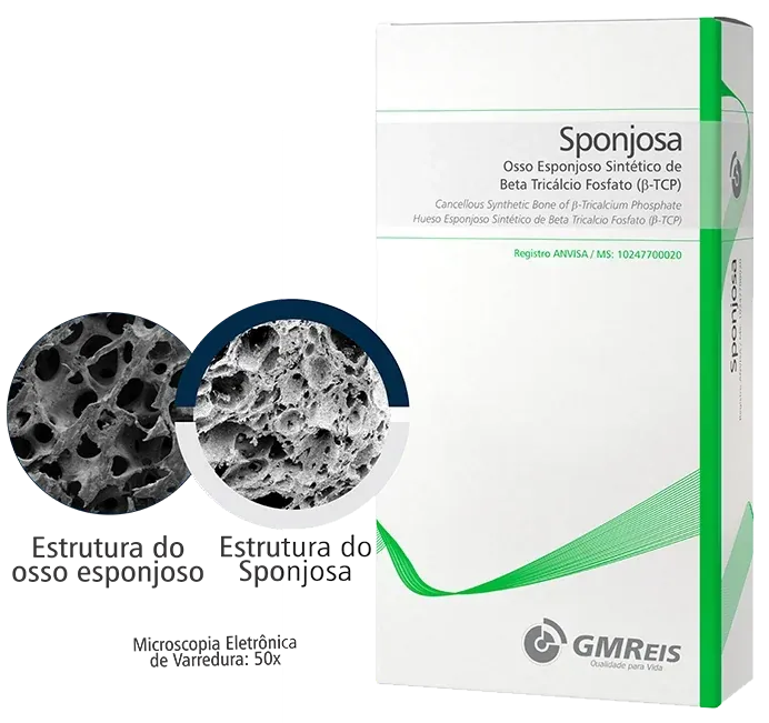 Sponjosa