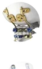 Occipitocervical e posterior