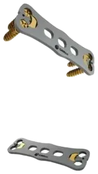 Placa Sophira® — Artrodese cervical anterior · GM Reis