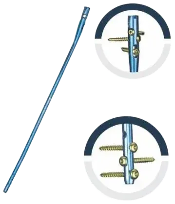 Tibiamax C®
