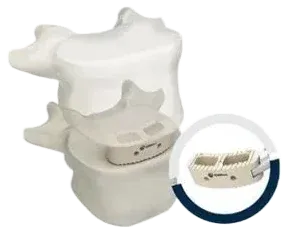 Coluna lombar