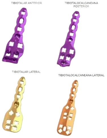 Sistema Versalock® de Artrodese do Tornozelo